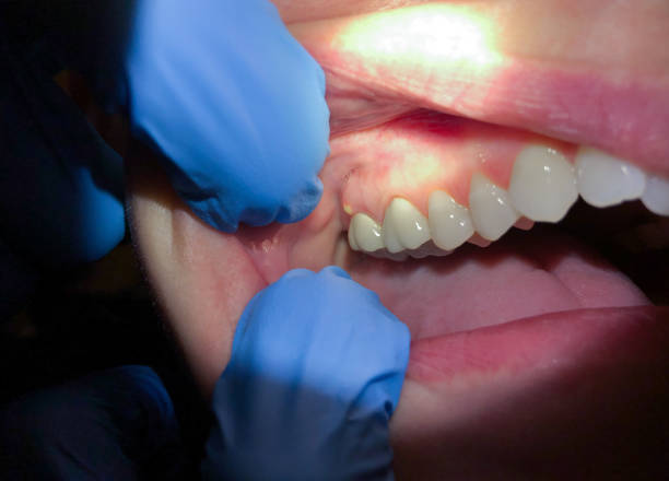 Best Emergency Dentist for Special Needs Patients in Lakeview, MI